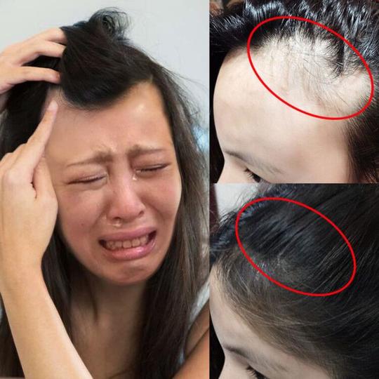 抖音发际线填充修容粉神器遮高额头修鬓角发髻线阴影笔防水补发