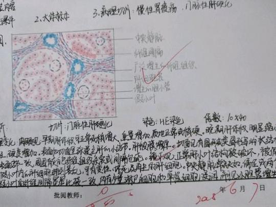 回复:搜集各种病理学红蓝铅笔手绘图