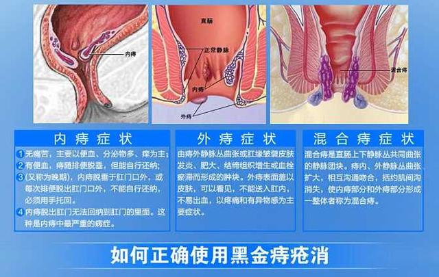 孕妇皮肤瘙痒挂什么科室好