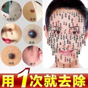 【天津 点痦子】长尾关键词有什么