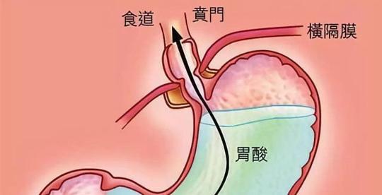 什么情况下做胃镜检查?胃镜检查很痛苦吗?