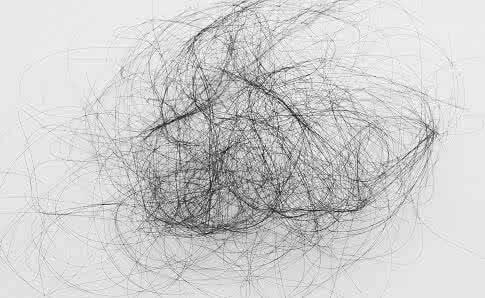 溢脂性脱发怎么治疗最彻