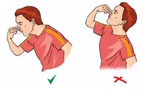 孩子鼻出血怎么办?