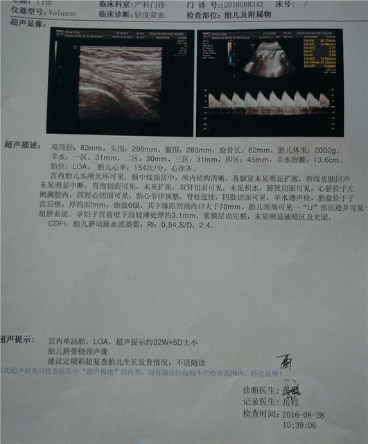 b超能检查出什么