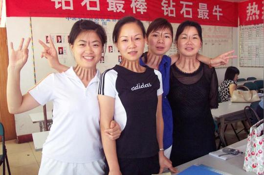 赞四女集体&lt;strong&gt;揪痧&lt;/strong&gt;