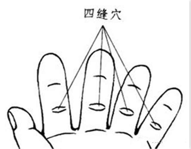 小儿疳积怎么办?