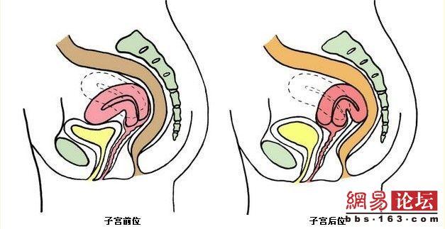 子宫后位会有什么影响,需要治疗吗