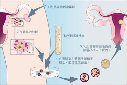 做试管婴儿的费用大概是多少