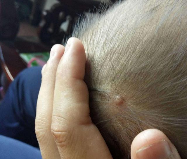 宝宝睡觉老摇头是怎么回事儿