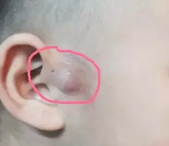宝宝的饮食应该注意什么