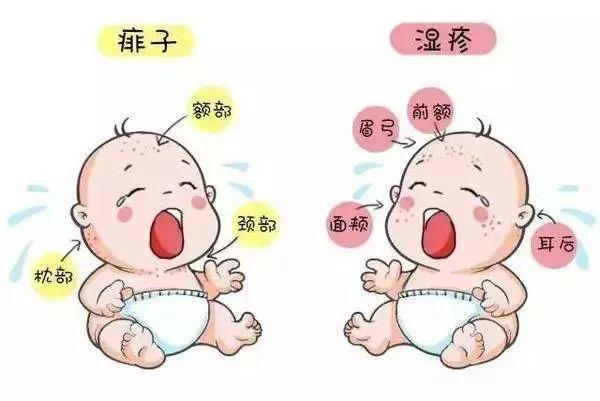 痱子和湿疹有什么区别图片