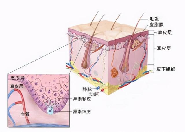 痘印怎么去除最有效的方法