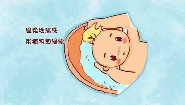 新生儿头上乳痂怎么清洗干净