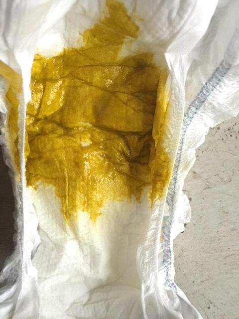 宝宝拉大便多久一次正常