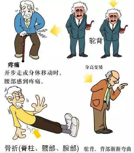 生孩子后骨质疏松