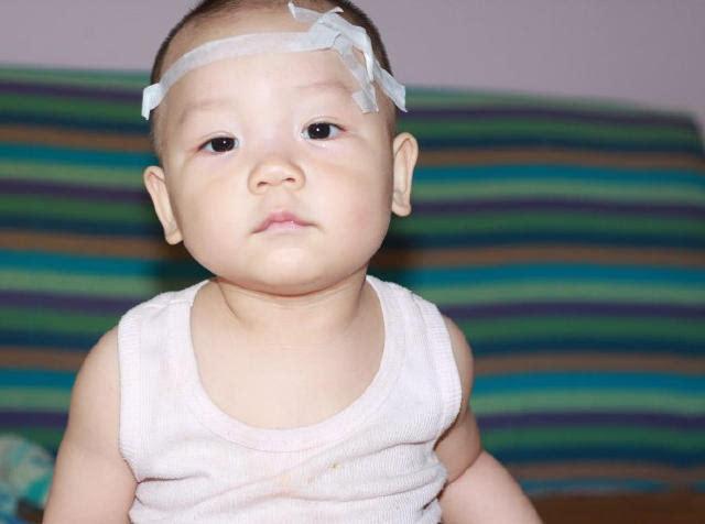 便秘会影响孩子身高吗