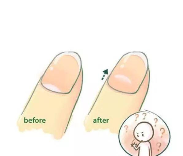 指甲上的白月牙是什么意思