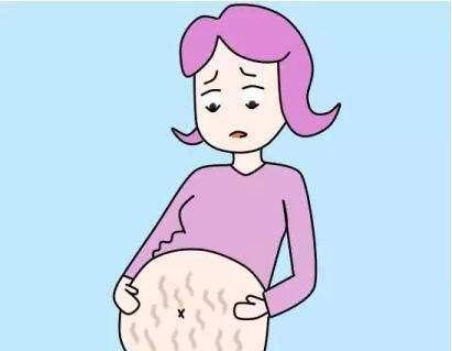 怀孕什么时候长妊娠纹的前兆