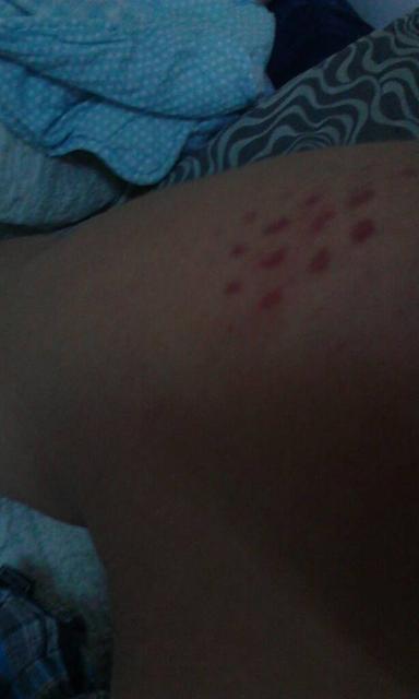 怀孕晚期下体痒怎么回事