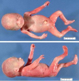 胎儿头和脚在哪个位置