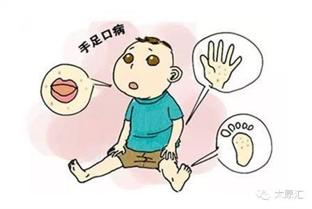 手足口病又来了吗
