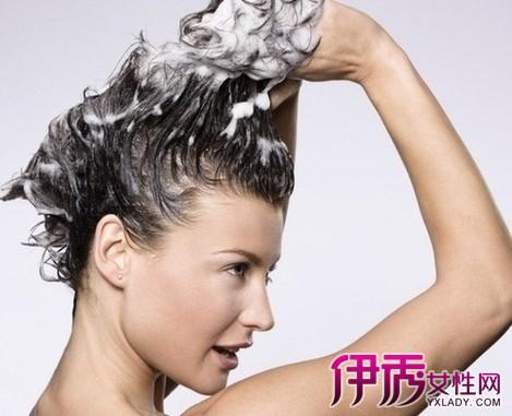 溢脂性脱发怎么治疗最彻