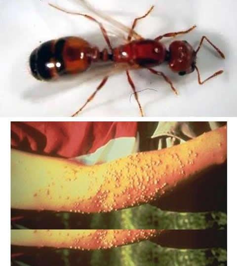 被毒虫咬伤会有什么症状