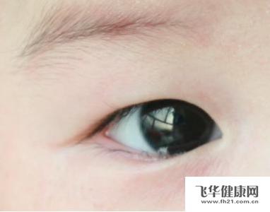 宝宝泪囊炎有哪些症状