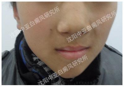 防晒喷雾喷到嘴唇上怎么办