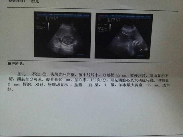 孕晚期双顶径和股骨长相差多少正常