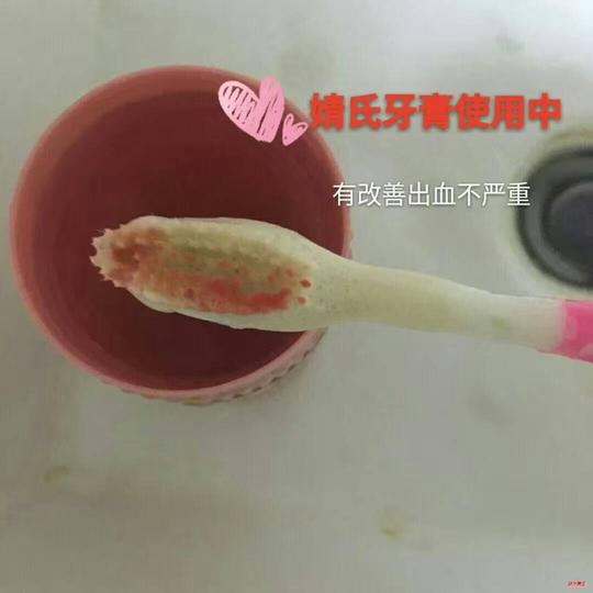 聚米婧氏草本牙膏多少钱?好用吗?