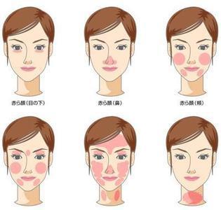 冬季孕妇需要注意什么