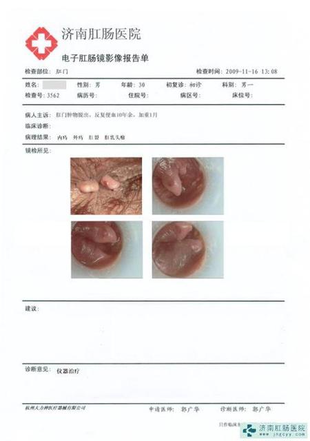 孩子得痔疮的多吗