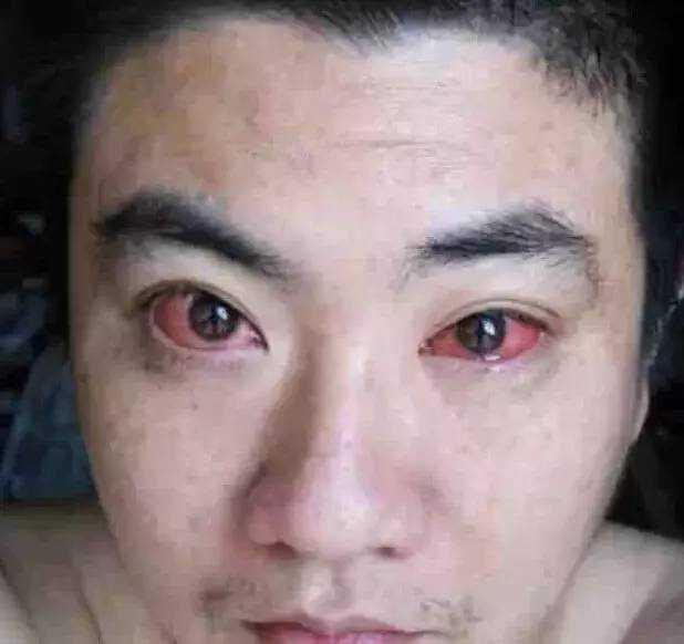 手机对婴幼儿的危害有哪些