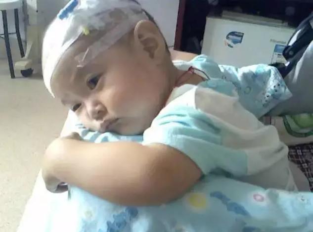 脾胃虚的宝宝吃什么辅食