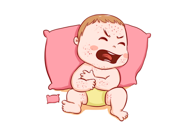 宝宝为什么有口水疹