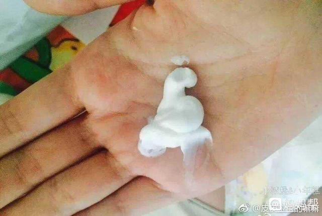 宝宝冬季起湿疹怎么办