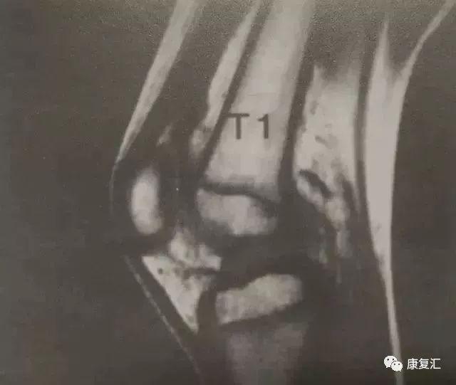 孩子每天运动多长时间最好