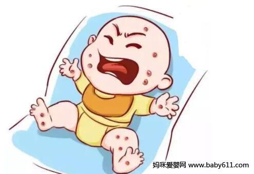 新生儿常见的皮肤问题