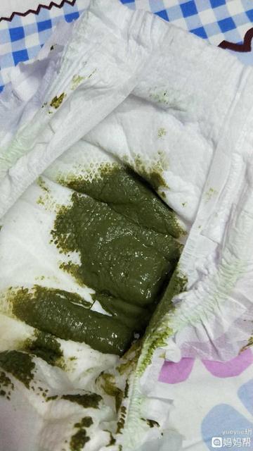 喝奶粉的宝宝大便绿色正常吗