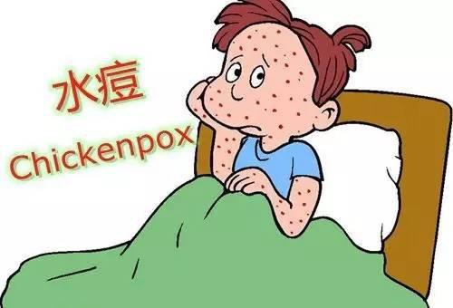 如何预防水痘小知识