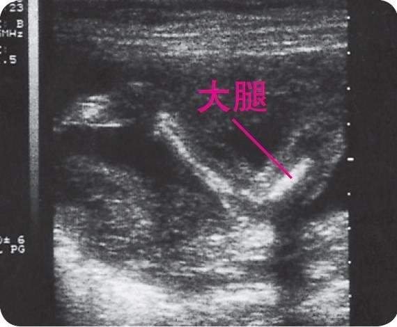 超声波看胎儿的外貌