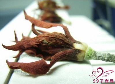 多发性子宫肌瘤会恶变吗