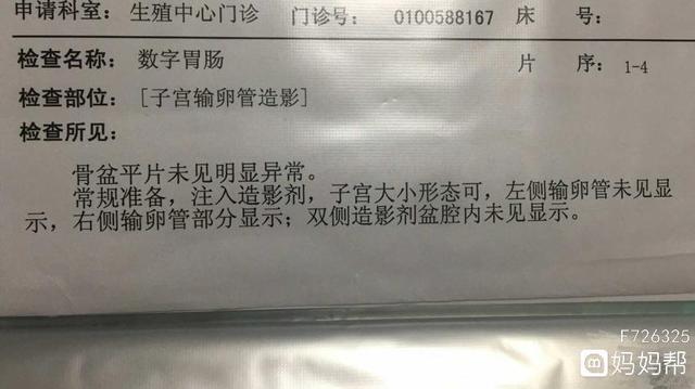 输卵管间质部妊娠特点