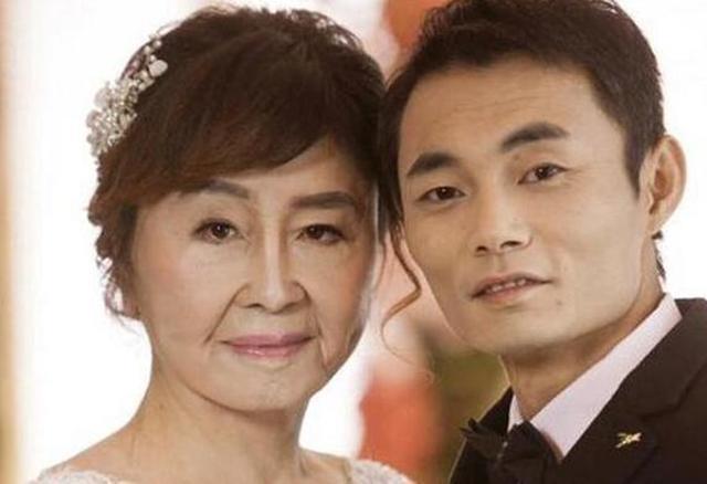 产后如何防止变老