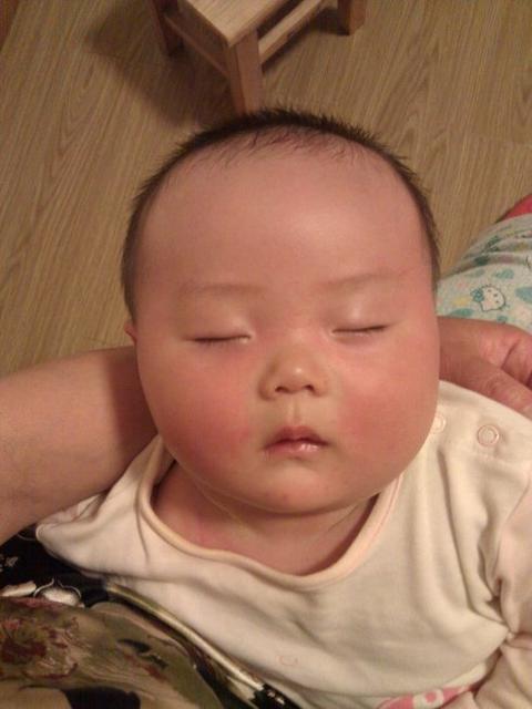 幼儿急疹和别的发烧有什么区别