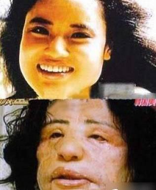 韩国兴起手机上瘾治疗