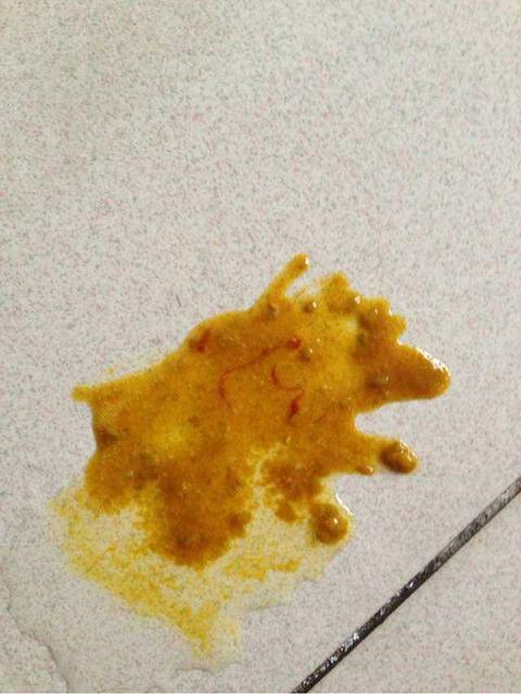 宝宝牛奶蛋白过敏怎么办