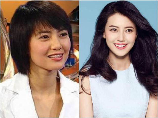 孩子牙齿什么情况需要矫正