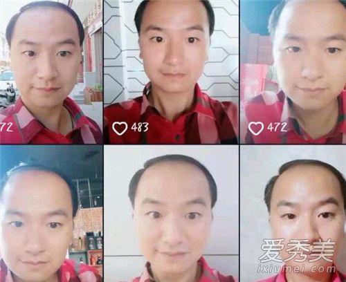 抖音陆超真实年龄多大朋友圈地中海中年男子是怎么火的
